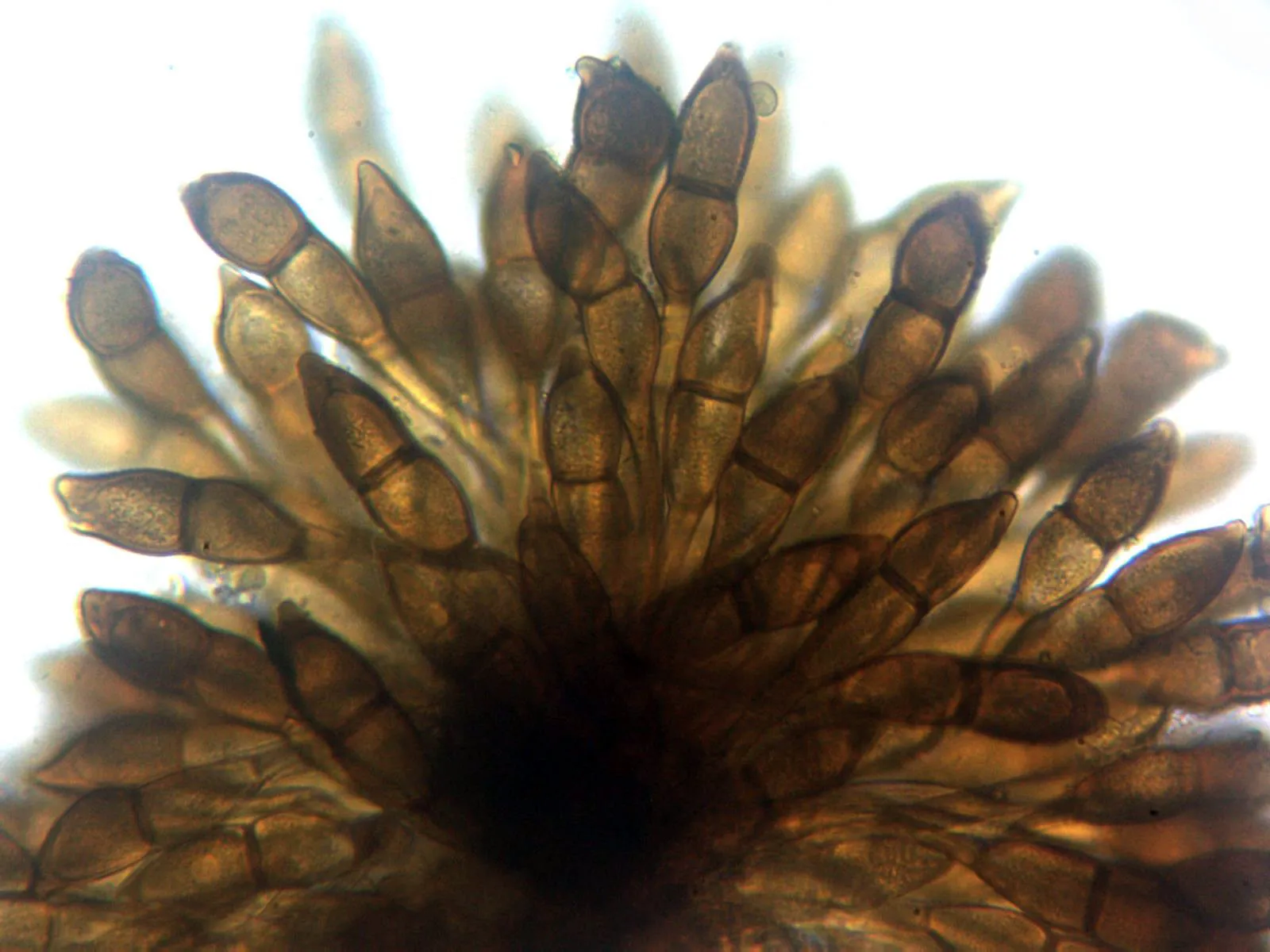 Microscopía de Puccinia phragmitis - 10 - Teliosporas agua x 400